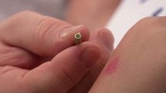 Одуванчик против укуса осы. Доброе утро. Фрагмент выпуска от 09.07.2015