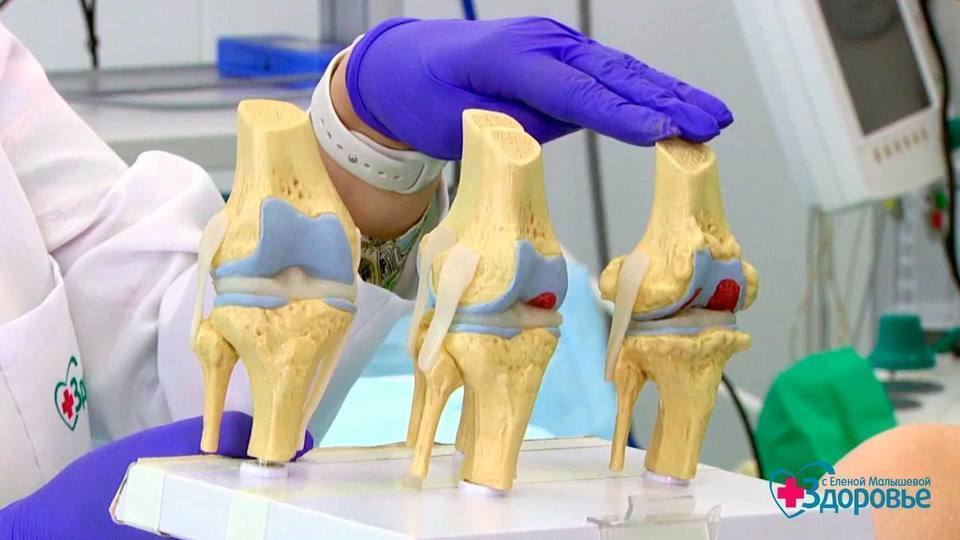 почему хрустит при движении сустава под лопаткой