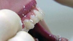 Чем заменить зубную щетку. Доброе утро. Фрагмент выпуска от 24.02.2015