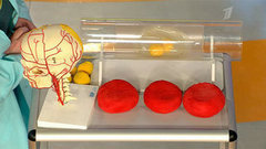 Жить здорово! Выпуск от 26.06.2014