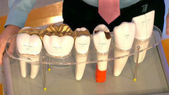 Жить здорово! Выпуск от 07.04.2014