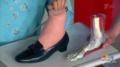 Вывих стопы. Жить здорово! Фрагмент выпуска от 12.07.2017
