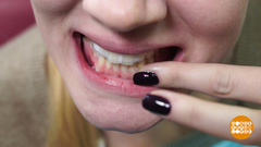 Профилактика пародонтита. Доброе утро. Фрагмент выпуска от 27.11.2018