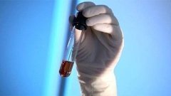 «Народная медицина. Сосуды». Документальный фильм