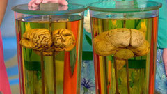 Жить здорово! Выпуск от 30.06.2014