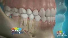 Как не растерять здоровые зубы. Пародонтит. Жить здорово! Фрагмент выпуска от 20.04.2017