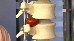 Зарядка против боли в пояснице. Жить здорово! Фрагмент выпуска от 25.02.2015