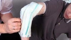 Дегтярное мыло от гематомы