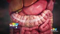 Запоры. Как нормализовать стул? Жить здорово! Фрагмент выпуска от 01.03.2017