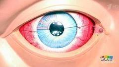 Почему у нас глаза красные? Жить здорово! Фрагмент выпуска от 24.05.2017