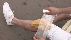 Банан от гематомы. Доброе утро. Фрагмент выпуска от 15.09.2015