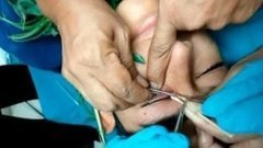 В мире. Перу: червь-паразит. Доброе утро. Фрагмент выпуска от 08.07.2015