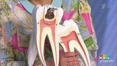 Кариес у детей. Жить здорово! Фрагмент выпуска от 13.07.2017