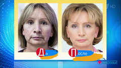 Красота с командой доктора Пухова. Круговая подтяжка лица. Здоровье. Фрагмент выпуска от 21.01.2018