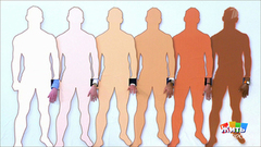 Солнце и кожа. Какой вы фототип? Жить здорово! Фрагмент выпуска от 30.05.2018