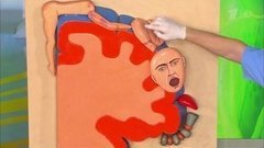 Микроинсульт. Как его отличить от инсульта? Жить здорово! Фрагмент выпуска от 05.02.2016
