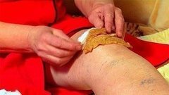 «Народная медицина. Суставы». Документальный фильм