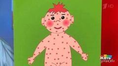 Корь. Детская болезнь. Жить здорово! Фрагмент выпуска от 02.03.2017