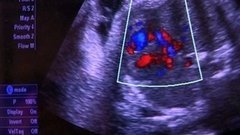 Хочу все знать. Мальчик или девочка? Доброе утро. Фрагмент выпуска от 29.04.2015