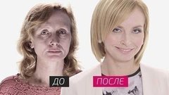 На 10 лет моложе. Выпуск от 03.05.2015