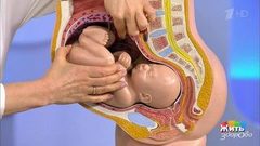 Дважды рожденный. Уникальная операция. Жить здорово! Фрагмент выпуска от 14.03.2019