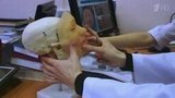 Впервые в России удалось пересадить человеческое лицо пациенту с тяжелейшим ожогом от удара током