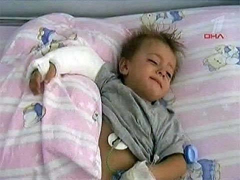 В турции трехлетний мальчик упал с балкона и чудом остался ж.