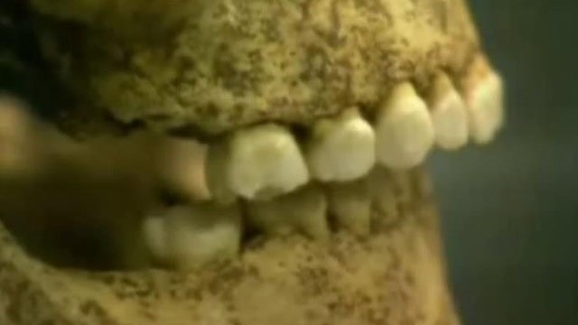 Как лечили зубы в древности?
