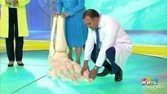 Плоскостопие и шишки на ногах. Жить здорово! Фрагмент выпуска от 13.10.2017