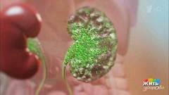 Боль в пояснице. Пиелонефрит. Жить здорово! Фрагмент выпуска от 03.04.2019