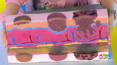 Родинки: удалить нельзя оставить. Жить здорово! Фрагмент выпуска от 08.05.2019