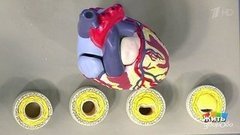 В группе риска: инфаркт. Жить здорово! Фрагмент выпуска от 25.05.2020