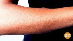 Потягушки? Мурашки? Это неспроста! Доброе утро. Фрагмент выпуска от 09.06.2020