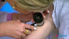 Тестируем гаджеты. Дерматоскоп в смартфоне. Здоровье. Фрагмент выпуска от 28.06.2020