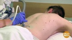 Осторожно, родинки! Доброе утро. Фрагмент выпуска от 28.07.2020