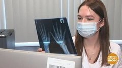 Артриту — нет! Доброе утро. Фрагмент выпуска от 12.10.2020