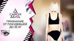 Шокирующая история истощенной до 35 килограммов. На самом деле