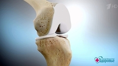 Лечим боль в суставах без таблеток. Здоровье. Фрагмент