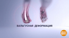 Правильная летняя обувь. Доброе утро. Фрагмент