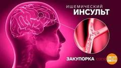 Инсульт: кто в группе риска? Доброе утро. Суббота. Фрагмент