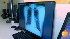 Осторожно, пневмония! Доброе утро. Суббота. Фрагмент