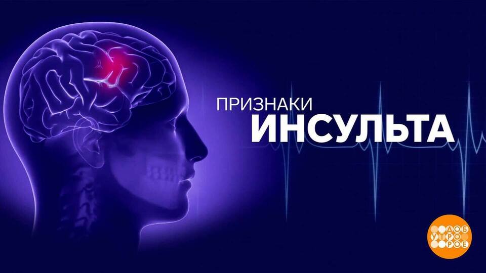 Инсульт: главное — не упустить время! Доброе утро. Фрагмент выпуска от 29.10.2024