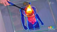 Глупые вопросы онкологу. Жить здорово! Фрагмент 