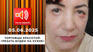 Торговцы красотой. Эпизод 3: «Резать будем на кухне». Пусть говорят