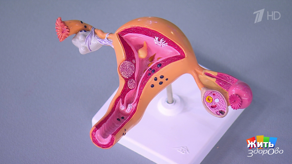 Хламидиоз как причина рака. Жить здорово! Фрагмент выпуска от 14.10.2025