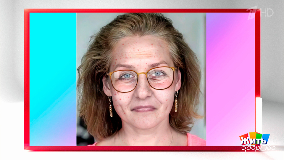 О каких дефицитах на лице написано? Жить здорово! Фрагмент выпуска от 16.10.2025