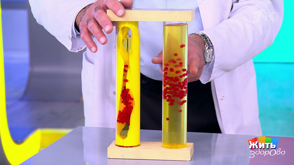 Пальмовое масло опасно для здоровья? Жить здорово! Фрагмент выпуска от 20.10.2025