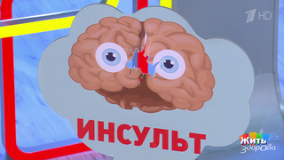 Гипертония не купируется таблетками? Проверьте почки. Жить здорово! Фрагмент 