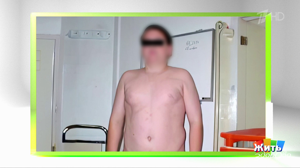 Ребенок толстеет — чтобы его заметили? Жить здорово! Фрагмент выпуска от 24 .11.2025