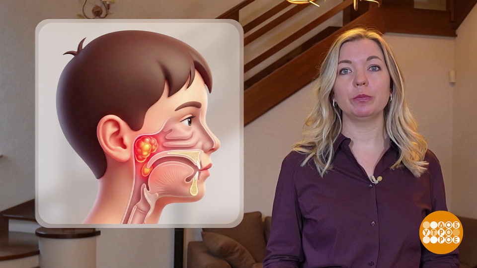 Если у ребенка аденоиды… Доброе утро. Фрагмент выпуска от 16.12.2025